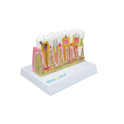 Modelo de Patologias Dentárias SD-5202