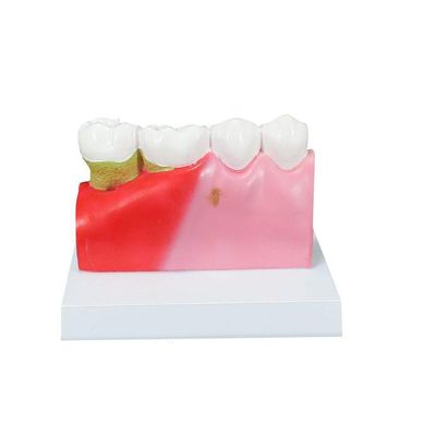 Modelo de Patologias Dentárias SD-5202