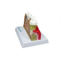Modelo de Patologias Dentárias SD-5202