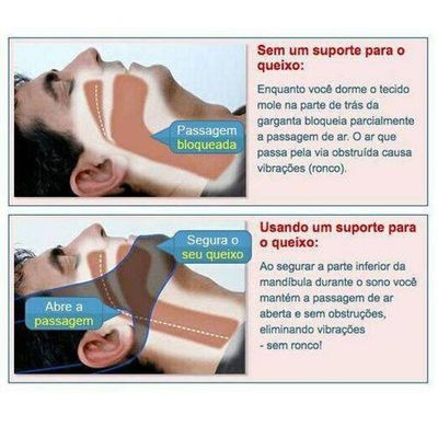 Faixa de Cabeça 3 Pontas Queixo Anti Ronco Apneia Preto
