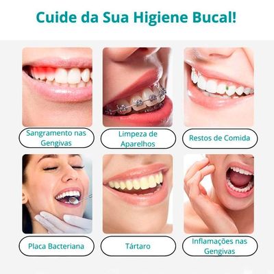 Irrigador Oral Jato D'água Higiene Bucal Sem Fio Cor:branco