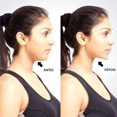 Massageador Remove Papada Musculo Pescoco Beleza Exercitador