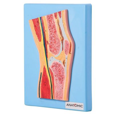 Secção Mediana da Articulação do Joelho Anatomia