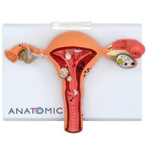 Útero Comtrompas Patológico Em Prancha, Anatomia