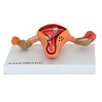 Útero Comtrompas Patológico Em Prancha, Anatomia