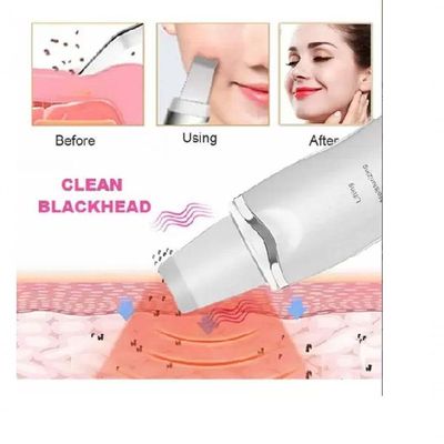 Limpeza Facial Peeling Ultrassônico Portátil