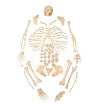 Esqueleto Humano Padrão Desarticulado