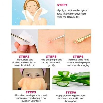Kit 4 Extrator Cureta Tira Acne Cravos E Espinha Limpeza