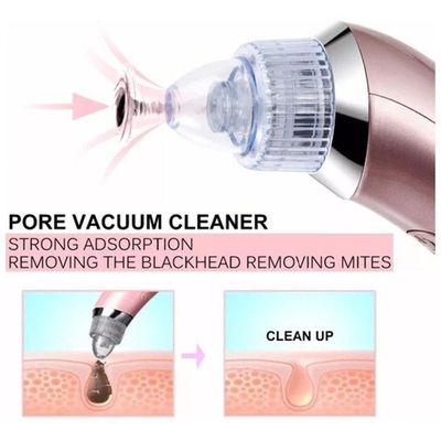 Máquina Sucção A Vácuo Remove Cravo Aparelho Acne Cleaning