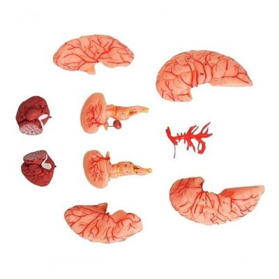 Cérebro Humano com Artérias em 9 Partes