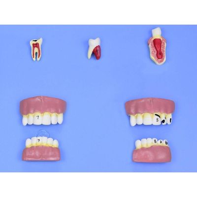Modelo de Patologias Dentárias em 12 Partes em Placa