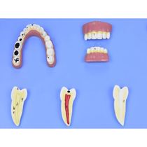 Modelo de Patologias Dentárias em 12 Partes em Placa