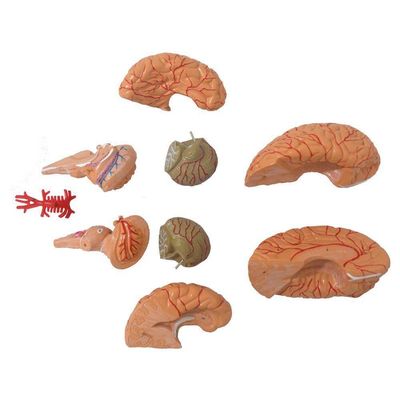 Cérebro Humano com Artérias em 9 Partes