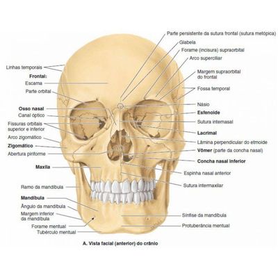 Crânio Humano Mandíbula E Calota Móvel E 3 Dentes Móveis